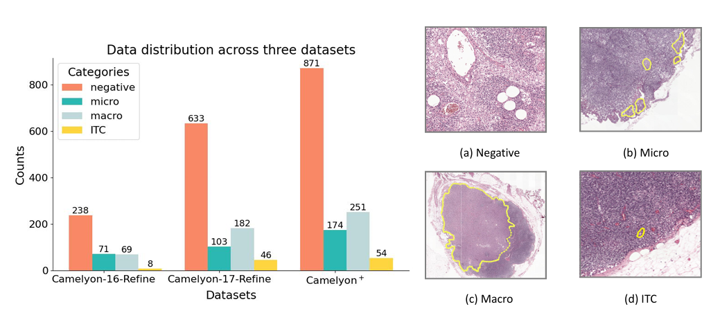 Towards a comprehensive benchmark for pathological lymph node metastasis in breast cancer sections